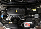 HPS Performance Shortram Air Intake Kit Installed 2011-2016 Hyundai Elantra 1.8L 827-538WB
